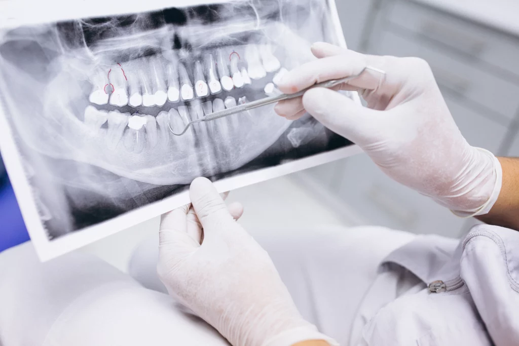 implantologia-dentale-roma