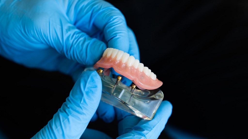 protesi-dentaria