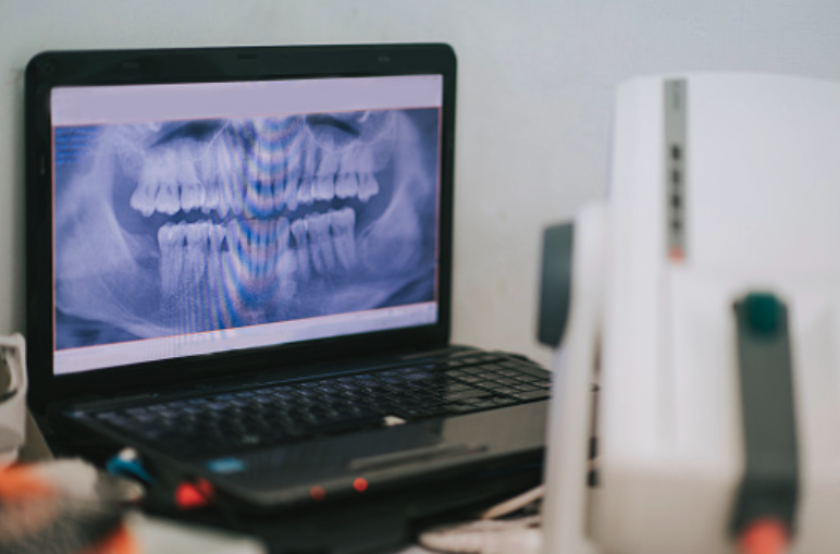 monitoraggio digitale impianti dentali