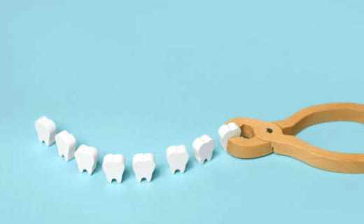 denti-delgiudizio-estrazione