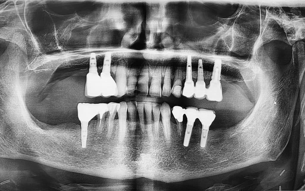Ortopantomografia-dentaria2